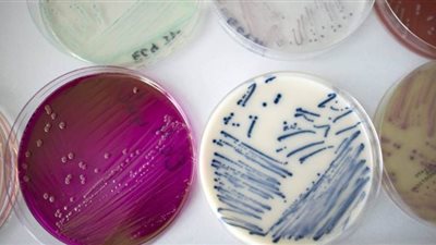 كيف تقتل أيونات الفضة البكتيريا الخارقة؟