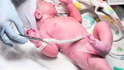 تخزين الحبل السري.. أول هدية لطفلك لحمايته من الأمراض المزمنة