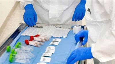 الصحة العالمية: مصر تشارك مع 90 دولة في إنتاج علاج ضد كورونا | فيديو