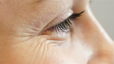 أفضل الطرق التجميلية لإزالة تجاعيد الوجه