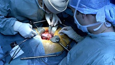 انفراجة تاريخية.. ضوابط ومحاذير زرع الأعضاء في القانون الجديد 