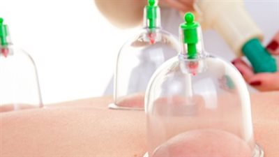 تفسير رؤية الحجامة في المنام وعلاقتها بالطلاق والموت وخسارة الأموال 