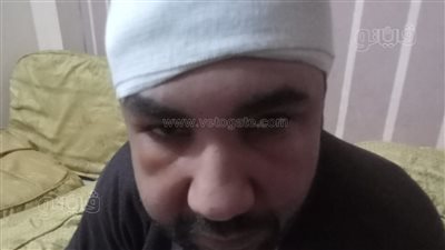 أصابه بـ 17 غرزة.. حبس سائق 15 يوما لاعتدائه على مسعف بالغربية
