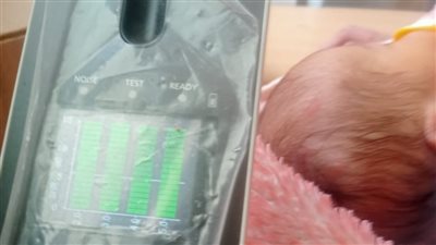 توقيع الكشف الطبي على 11 ألف طفل حديث الولادة بالمنيا