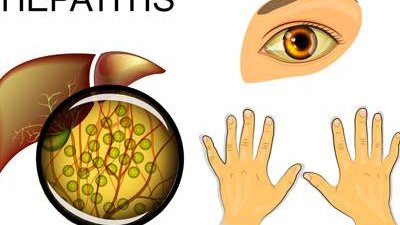 الفيروس الغدي 41.. كلمة السر وراء انتشار الوباء الجديد|فيديو