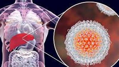 خطورة الإصابة بفيروس الكبد B