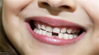 تفسير حلم تساقط الأسنان في المنام وعلاقته بالحيرة واليأس والخيانة والخداع 