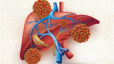 الصحة العالمية: توفير أدوية التهاب الكبد B بـ2 دولار شهريا للدول منخفضة الدخل 