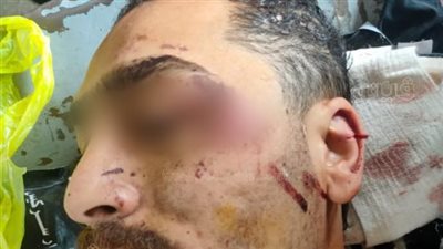 رفضوا الصلح.. صاحب ورشة و4 آخرين يعتدون على أشقاء طليقته بالمحلة