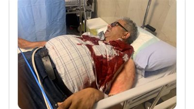 أول ظهور للصحفي الفلسطيني علي السمودي بعد إصابته برصاصة على يد جنود الاحتلال