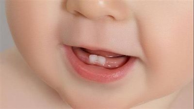 نصائح للحفاظ علي أسنان الأطفال