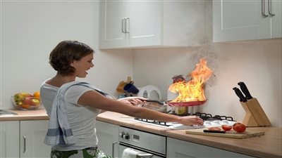 علاج الحروق البسيطة بالمنزل بالوصفات الطبيعية