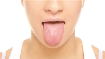 دلالات تغير لون اللسان على الحالة الصحية 