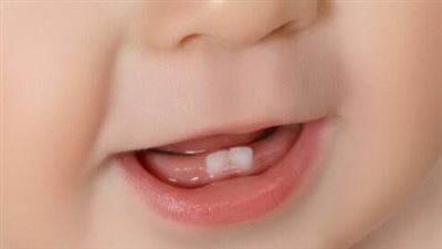 التفسير العلمي لظهور أسنان للطفل عقب ولادته مباشرة 