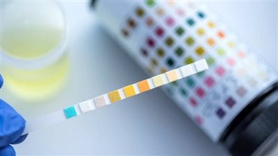 تعرف خدمات المعامل المركزية لإجراء تحليل الكشف عن المخدرات 