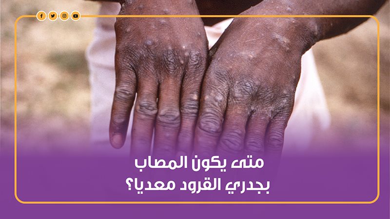 جدري القرود يؤدي