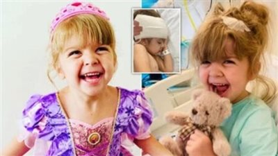 حالة نادرة.. شفاء طفلة من العمى يذهل الأطباء