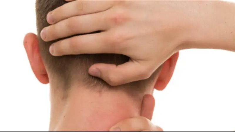  صداع خلف الرأس