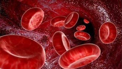 أسباب الإصابة بمرض أنيميا البحر المتوسط 