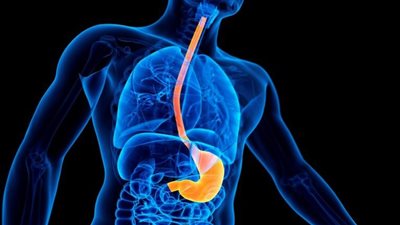 أعراض ارتجاع المريء 