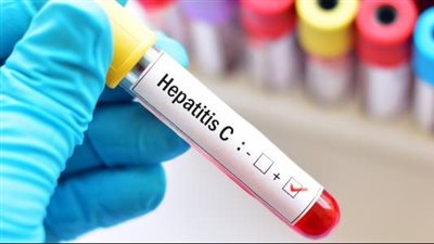 بعد حصول مصر عليها، ماذا تعني شهادة المستوى الذهبي في القضاء على فيروس C 