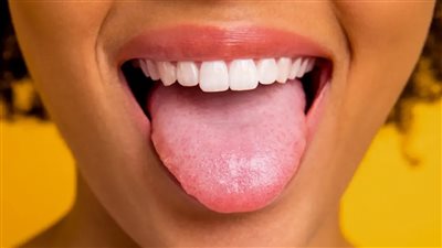 أبرزها نقص الحديد.. 10 أسباب لالتهاب اللسان وتشققه