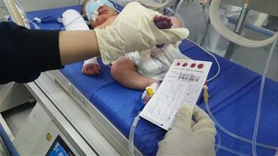 الصحة تكشف أسباب زيادة الإصابة بالأمراض الوراثية في مصر (فيديو)