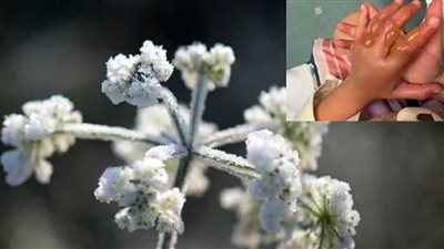 نبات خطير يتسبب في حرق يد فتاة