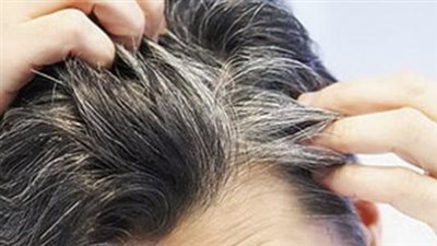  أسباب ظهور الشعر الأبيض مبكرا.. أبرزها عادات غذائية خاطئة وعوامل وراثية