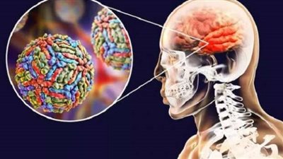 معدي وقاتل ويصيب الأطفال والرضع.. أعراض مرض الحصان الحزين