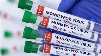  الوكالة البريطانية للصحة توصي بتلقيح الرجال المثليين ضد جدري القرود بشكل عاجل