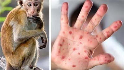 تحذير من الصحة العالمية بشأن انتقال عدوى جدري القرود من الإنسان للحيوانات
