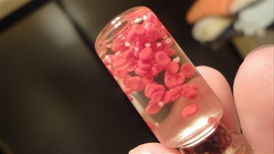 أسباب نقص الصفائح الدموية.. والأعراض وطرق العلاج من الطبيعة