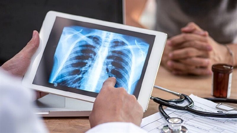 انفجار رئة شاب بسبب