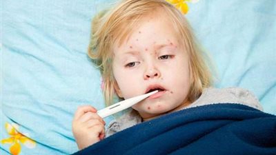 أعراض الحمى وأسبابها وطرق علاجها 