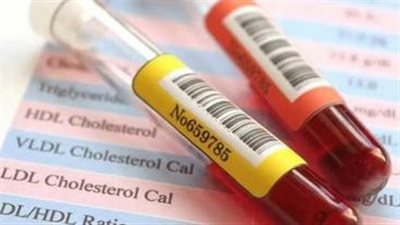 احذر.. العقاقير المخفضة للكوليسترول تصيب هؤلاء بالعمى