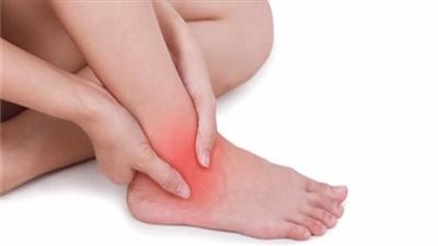 أسباب وأعراض القرح الوريدية بالساقين.. وطرق العلاج