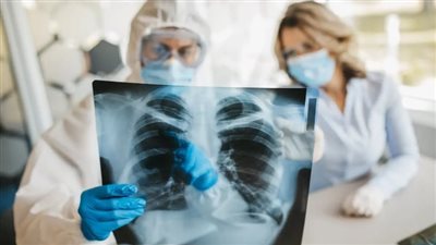 تقنية تصوير جديدة تكشف مصدر كوفيد طويل الأمد في الرئتين