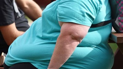 السمنة مرض، بكتيريا تتسلل من الأمعاء للدم وراء حدوث زيادة الوزن