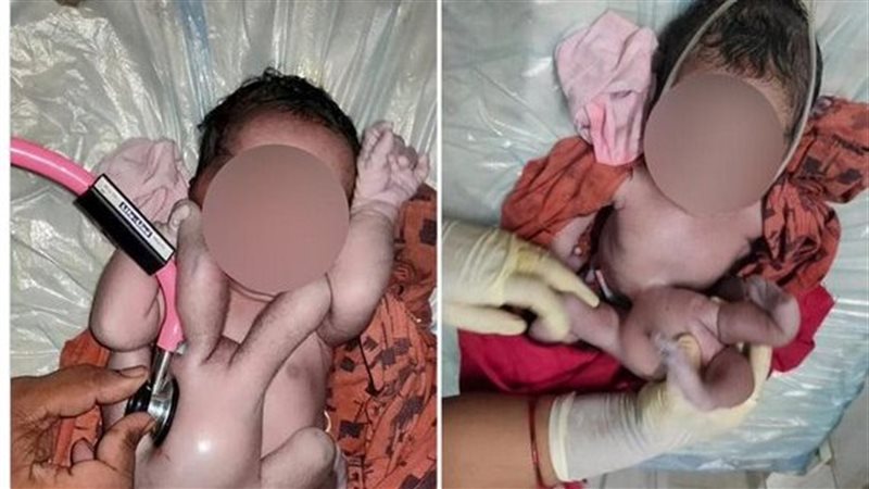  ولادة طفلة بأربع