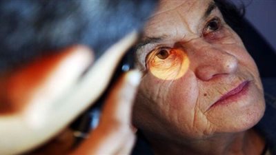 العلماء يحددون البروتين المسئول عن فقدان البصر