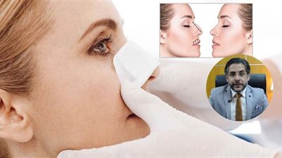كل ما تودين معرفته عن عمليات تجميل الأنف مع الدكتور وائل غانم