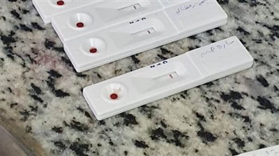 سلبية ٥٠ تحليلا من طاقم تمريض مستشفى التأمين بسندوب واشتباه في حالتين