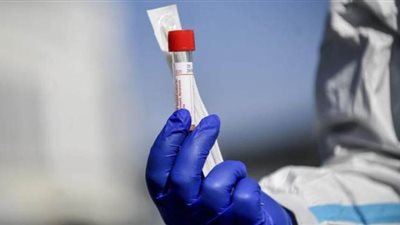 الكويت تعلن تعافي 101 مصاب بفيروس كورونا.. وإجمالي حالات الشفاء 1703