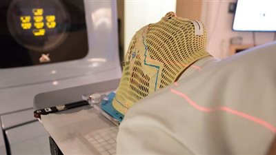 نتائج واعدة للاستعانة بعقار الفصام إلى جانب العلاج الإشعاعي في علاج أورام الدماغ