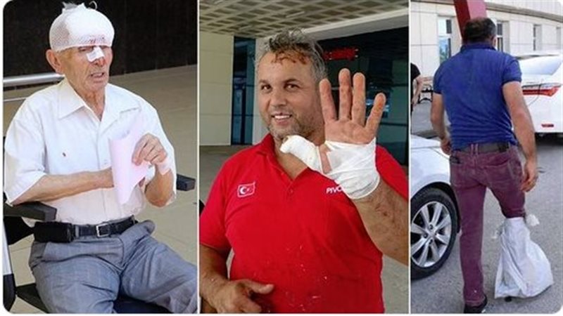 إصابة جزارين في تركيا