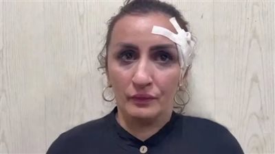 أم تبيع رضيعها بـ3600 دولار لإجراء عملية تجميل