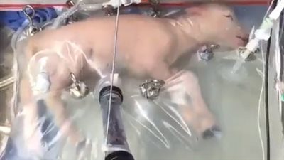 ثورة علمية.. رحم صناعي من البلاستيك لنمو الأطفال بدون إعاقة عقلية | فيديو