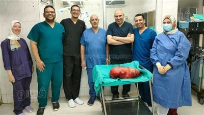 نجاح فريق طبي في استئصال ورم يزن 18 كيلو جراما من معدة مريض بطنطا
