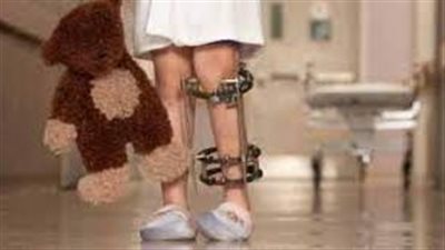 تسجيل أول حالة شلل أطفال في أمريكا بعد 9 أعوام من الاختفاء